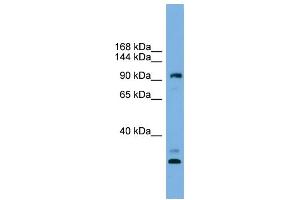 WB Suggested Anti-CCDC110 Antibody Titration: 0. (CCDC110 Antikörper  (Middle Region))