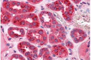 Immunohistochemistry (Formalin-fixed Paraffin-embedded Sections) (IHC (fp)) image for anti-Cysteine Rich Transmembrane BMP Regulator 1 (Chordin-Like) (CRIM1) (AA 36-146) antibody (ABIN574450)