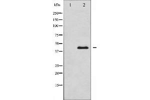 Western blot analysis of MEK1/2 expression in UV treated Jurkat whole cell lysates,The lane on the left is treated with the antigen-specific peptide. (MEK1 Antikörper  (Internal Region))
