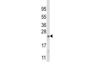 Western blot analysis of NQO2 antibody and mouse liver tissue lysate (NQO2 Antikörper  (AA 141-168))