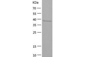 ASAH1 Protein (AA 22-395) (His tag)