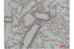 Immunohistochemistry (IHC) analysis of paraffin-embedded Mouse Lung Tissue using Cyclin D1 Rabbit Polyclonal Antibody diluted at 1:200. (Cyclin D1 Antikörper)