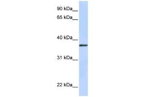 TTMB antibody used at 1 ug/ml to detect target protein. (TMEM200B Antikörper  (N-Term))