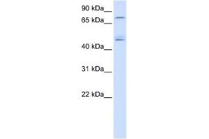 DDX1 antibody used at 1 ug/ml to detect target protein. (DDX1 Antikörper)