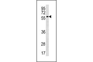 PLXDC2 Antibody (N-term) (ABIN1881663 and ABIN2843221) western blot analysis in NCI- cell line lysates (35 μg/lane). (PLXDC2 Antikörper  (N-Term))