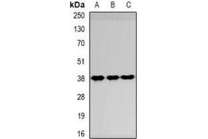 Western blot analysis of SPFH1 expression in HepG2 (A), NIH3T3 (B), Hela (C) whole cell lysates. (ERLIN1 Antikörper)