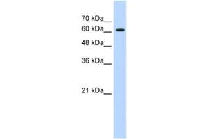 Western Blotting (WB) image for anti-ZIC2 (ZIC2) antibody (ABIN2461223) (ZIC2 Antikörper)