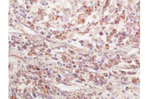 anti-Epidermal Growth Factor Receptor Pathway Substrate 15-Like 1 (EPS15L1) (AA 275-380) antibody