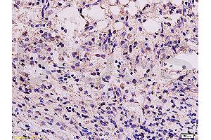 Formalin-fixed and paraffin embedded mouse kidney tissue labeled Anti-Vimentin Polyclonal Antibody, Unconjugated (ABIN672786) at 1:200, followed by conjugation to the secondary antibody and DAB staining (Vimentin Antikörper  (AA 371-466))