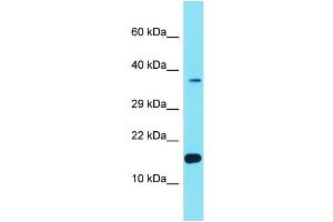Host: Rabbit Target Name: FER1L6-AS2 Sample Type: Hela Whole cell lysates Antibody Dilution: 1. (FER1L6-AS2 Antikörper  (Middle Region))
