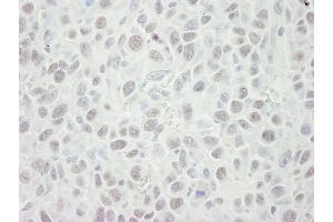 Immunohistochemistry (IHC) image for anti-Minichromosome Maintenance Complex Component 5 (MCM5) (AA 1-50) antibody (ABIN7448655) (MCM5 Antikörper  (AA 1-50))