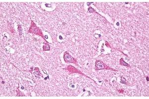 Anti-NDUFS7 antibody IHC staining of human brain, cortex neurons. (NDUFS7 Antikörper  (AA 58-68))