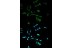 Immunofluorescence analysis of HeLa cells using SIRT7 antibody. (SIRT7 Antikörper)