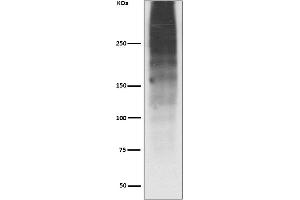 Western blot analysis of MUC16 expression in Human ovary cancer lysate.
