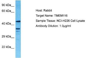 Host: Rabbit Target Name: TMEM116 Sample Tissue: Human NCI-H226 Whole Cell Antibody Dilution: 1ug/ml (TMEM116 Antikörper  (C-Term))