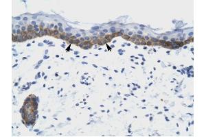 NUDT9 antibody was used for immunohistochemistry at a concentration of 4-8 ug/ml to stain Squamous epithelial cells (arrows) in Human Skin. (NUDT9 Antikörper)