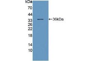 Western blot analysis of recombinant Human DNAH11. (DNAH11 Antikörper  (AA 17-299))