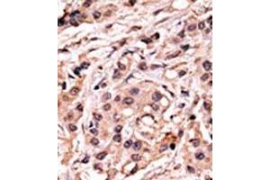 Image no. 1 for anti-Tumor Protein P53 (TP53) (pSer20) antibody (ABIN358188) (p53 Antikörper  (pSer20))