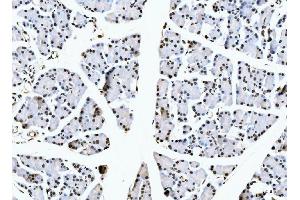 IHC analysis of NCL using anti-NCL antibody (ABIN7600662).