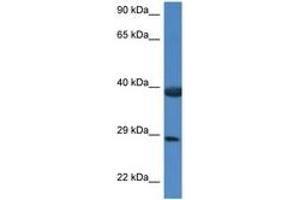 Image no. 1 for anti-HSPA Binding Protein, Cytoplasmic Cochaperone 1 (HSPBP1) (AA 226-275) antibody (ABIN6747386) (HSPBP1 Antikörper  (AA 226-275))