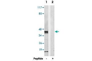 Western blot analysis of extracts from HepG2 cells, using MRPS36 polyclonal antibody . (MRPS36 Antikörper)