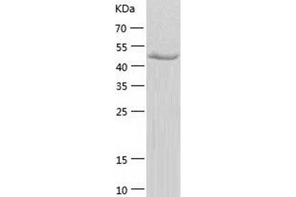 IP6K1 Protein (AA 1-441) (His tag)