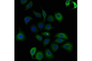 Immunofluorescence staining of A549 cells with ABIN7140197 at 1:50, counter-stained with DAPI. (Trichohyalin Antikörper  (AA 1922-1941))