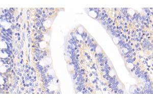 Immunohistochemistry (IHC) image for anti-Interleukin-1 Receptor-Associated Kinase 4 (IRAK4) (AA 189-427) antibody (ABIN7433738)