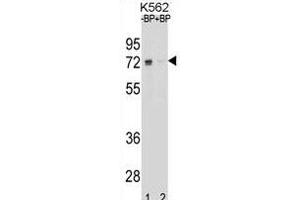 Western blot analysis of ESR1 isoform1 Antibody (C-term) Pab (ABIN1881317 and ABIN2838677) pre-incubated without(lane 1) and with(lane 2) blocking peptide in K562 cell line lysate. (Estrogen Receptor alpha Antikörper  (C-Term))