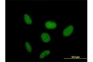 Immunofluorescence of purified MaxPab antibody to ZNF319 on HeLa cell. (ZNF319 Antikörper  (AA 1-582))