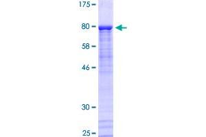 PKNOX2 Protein (AA 1-471) (GST tag)