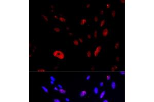 Immunofluorescence analysis of U2OS cells using HUS1 Polyclonal Antibody (HUS1 Antikörper)