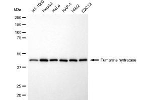 Western blotting analysis using fumarate hydratase antibody (ABIN7798665). (FH Antikörper)