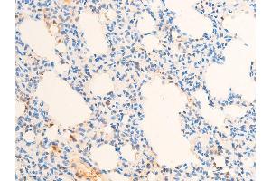 ABIN6267307 at 1/100 staining rat lung tissue sections by IHC-P. (C-JUN Antikörper  (pThr93))