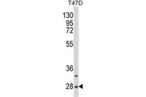 anti-Small Nuclear Ribonucleoprotein Polypeptides B and B1 (SNRPB) (AA 42-72), (N-Term) antibody