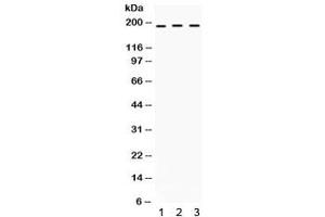 Western blot testing of human 1) SW620, 2) COLO320 and 3) HepG2 cell lysate with LIFR antibody. (LIFR Antikörper)