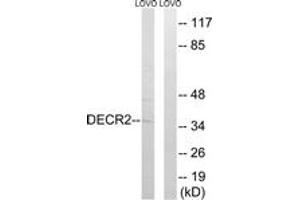 Western blot analysis of extracts from LOVO cells, using DECR2 Antibody.