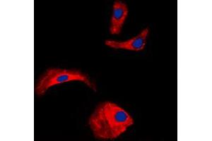 Immunofluorescent analysis of OLFML2A staining in HepG2 cells. (OLFML2A Antikörper  (Center))
