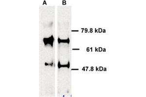 Human ABCE1 detected in immunoprecipitated samples using ABCE1 polyclonal antibody . (ABCE1 Antikörper)