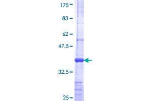 Image no. 1 for Advanced Glycosylation End Product-Specific Receptor (AGER) (AA 134-231) protein (GST tag) (ABIN1317326) (RAGE Protein (AA 134-231) (GST tag))