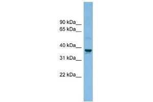 SLC30A3 antibody used at 1 ug/ml to detect target protein. (Slc30a3 Antikörper)