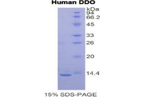SDS-PAGE analysis of Human D-Aspartate Oxidase Protein. (DDO Protein)