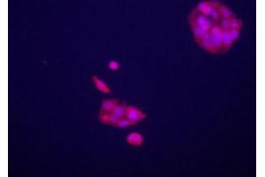 Immunofluorecence staining of anti-GPC3 Pab on HepG2 cells. (Glypican 3 Antikörper  (C-Term))