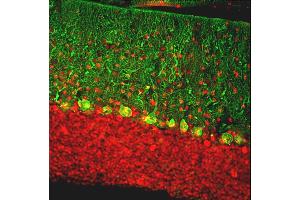 Immunofluorescent analysis of rat cerebellum section stained with chicken pAb to calbindin, ABIN8126692, dilution 1:2,000, in green, and costained with rabbit pAb to MeCP2, dilution 1:5,000, in red. (CALB1 Antikörper)
