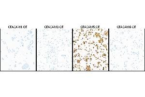 Immunocytochemistry (ICC) image for anti-Carcinoembryonic Antigen-Related Cell Adhesion Molecule 5 (CEACAM5) (AA 35-685) antibody (ABIN7453964) (Rekombinanter CEACAM5 Antikörper  (AA 35-685))