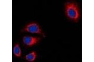 Immunofluorescent analysis of Focal Adhesion Kinase staining in HT29 cells. (FAK Antikörper  (C-Term))