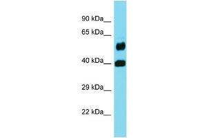 Western Blotting (WB) image for anti-Folate Hydrolase 1B (FOLH1B) (Middle Region) antibody (ABIN2436969) (FOLH1B Antikörper  (Middle Region))