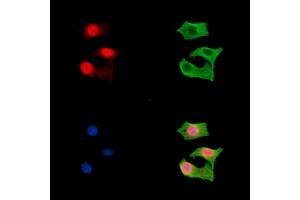 ABIN7096587 and ABIN7100651 staining HepG2 cells by IF/ICC. (CTC1 Antikörper)