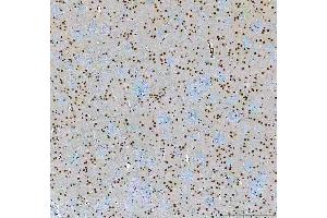 IHC analysis of SF3A3 using anti-SF3A3 antibody (ABIN7599863).