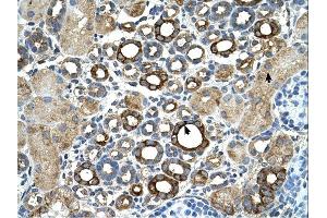 ST14 antibody was used for immunohistochemistry at a concentration of 4-8 ug/ml.